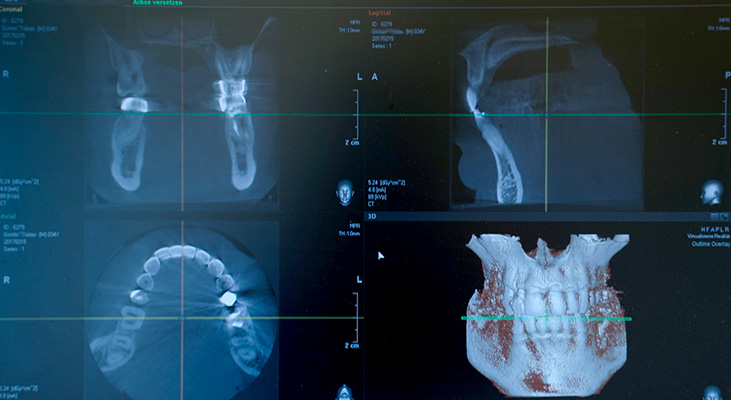 Digitales 3D Röntgen